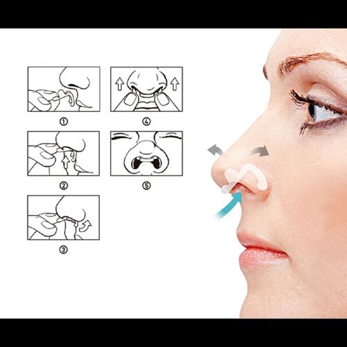 Dilatador Nasal Interno Flux Air M e G 2 Unidades