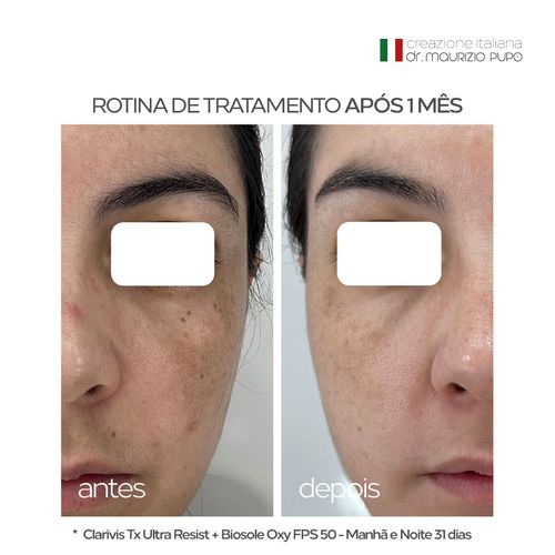 Sérum Clareador Clarivis Tx Ultra Resist Manchas e Melasma