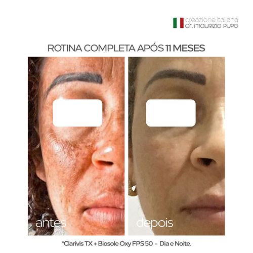 Clarivis Tx Sérum Clareador para Melasma e Manchas