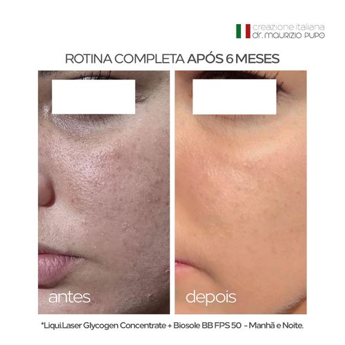Liqui.Laser Glycogen Concentrate: Sérum Clareador e Anti-idade para Peles 30+